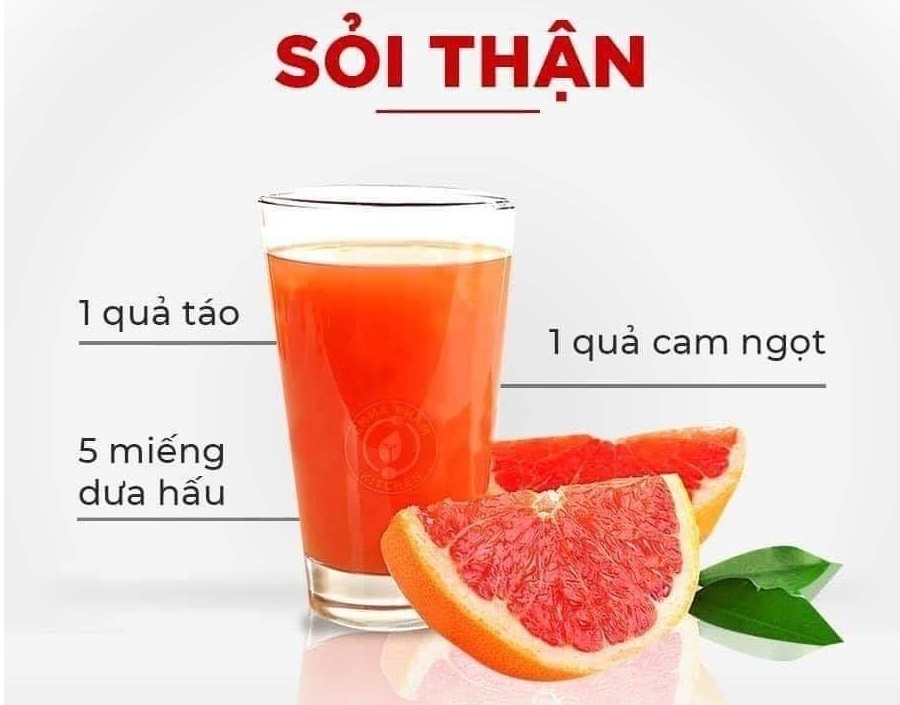 Sỏi thận - 8 loại nước công dụng cực kỳ hay